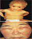 GNLD - DERMATOSIS IRRITATIVAS - NEO-LIFE